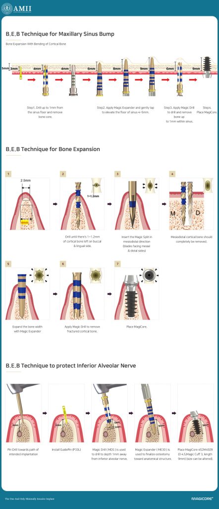 B.E.B Surgical System