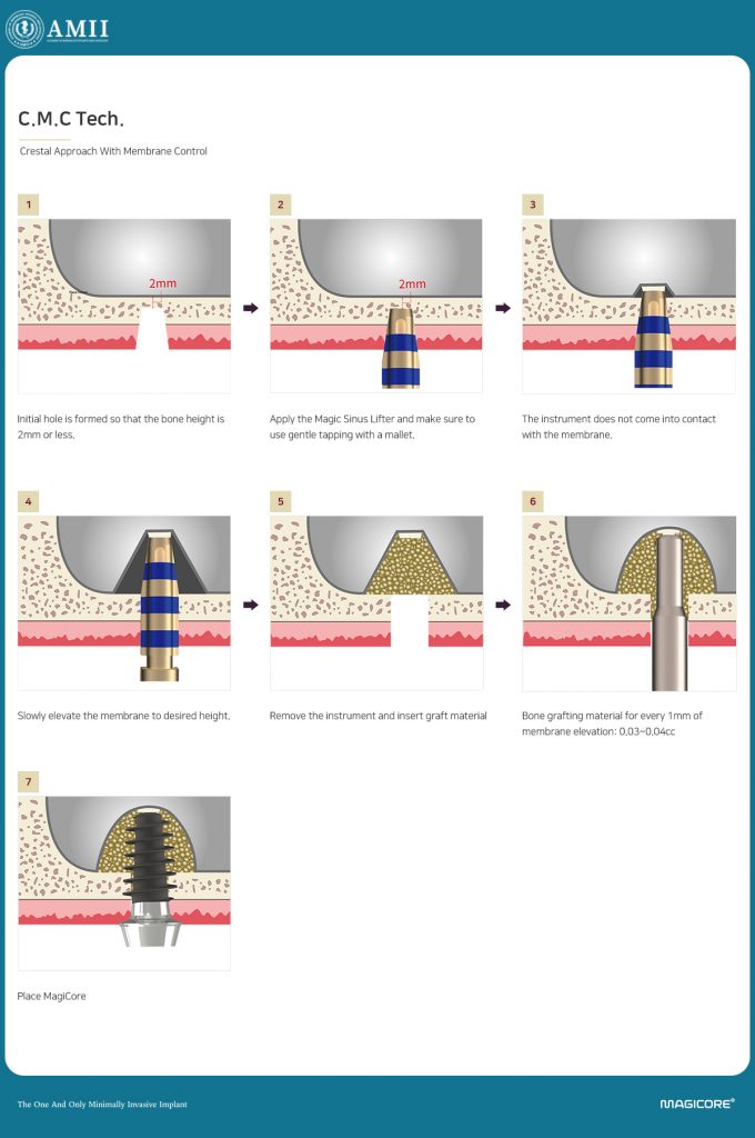 C.M.C Surgical System