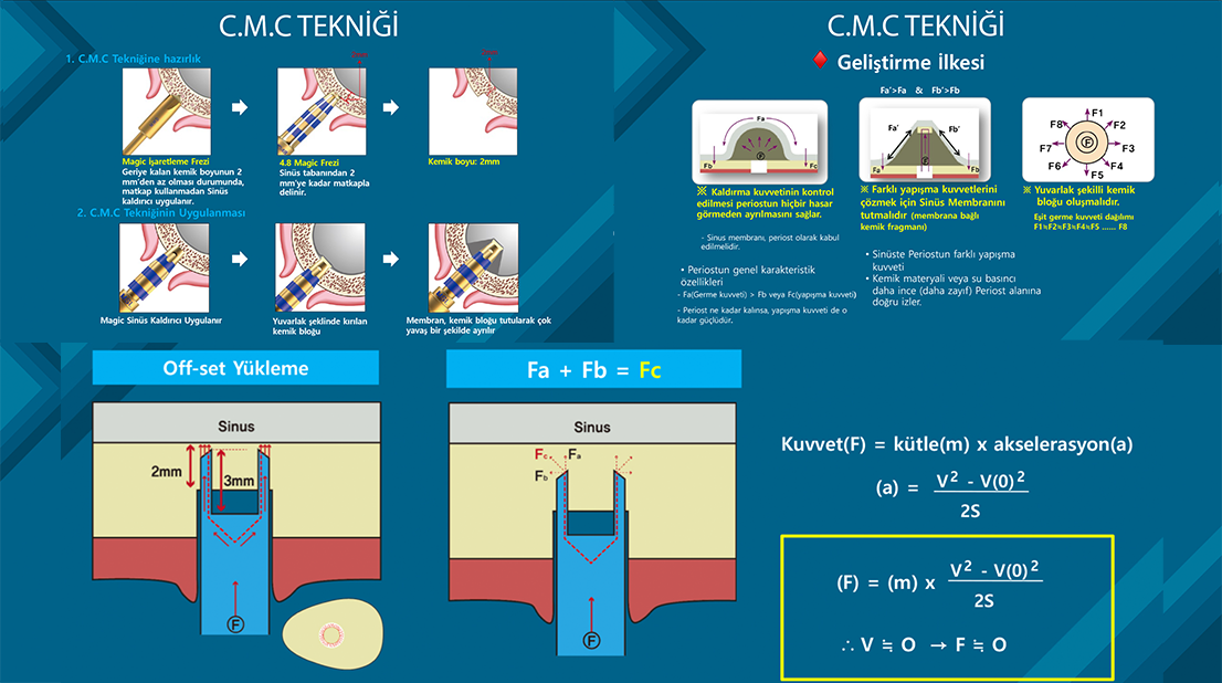 Implant C.M.C