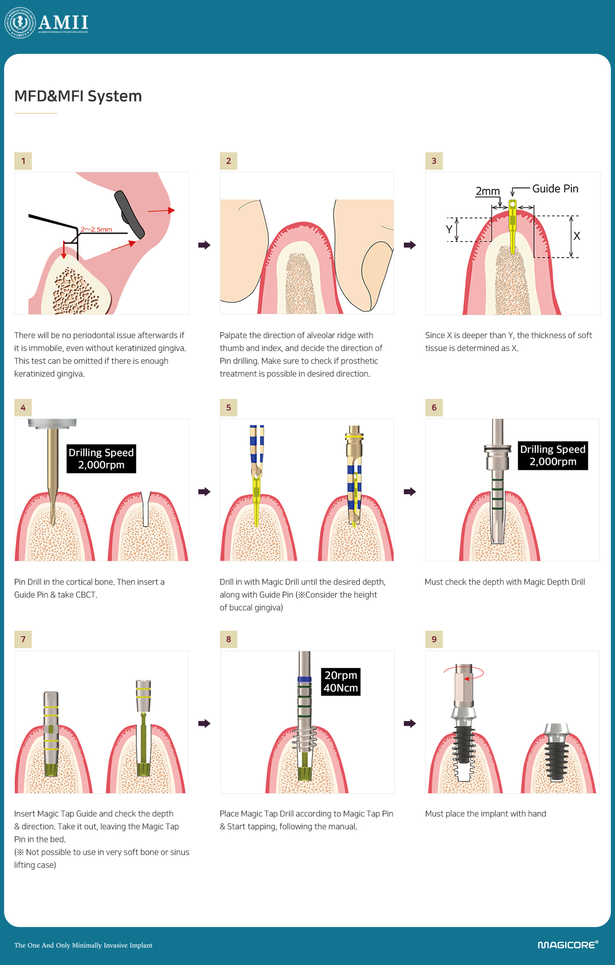 P.R.B Surgical System